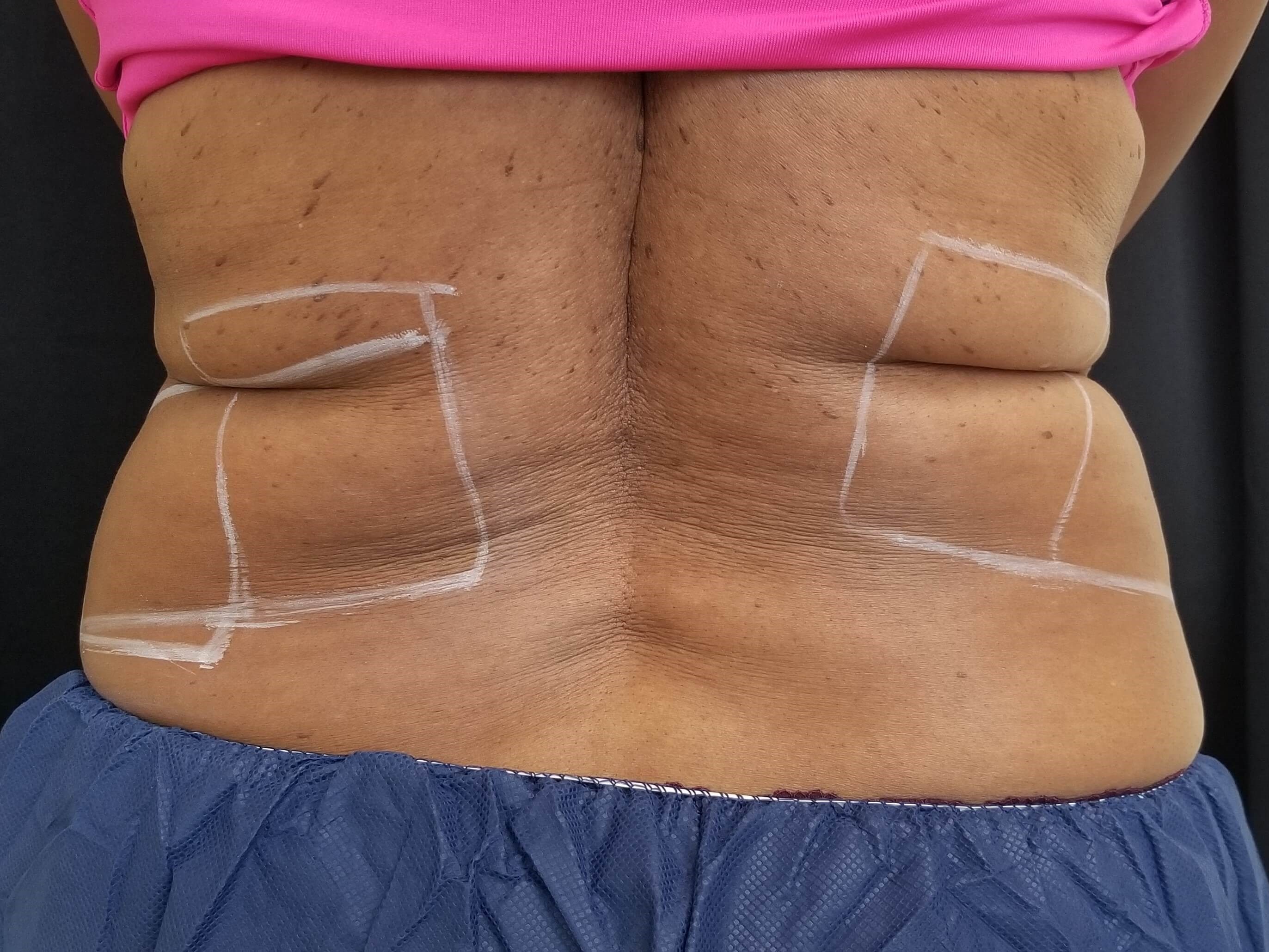 Before and After Pictures Before