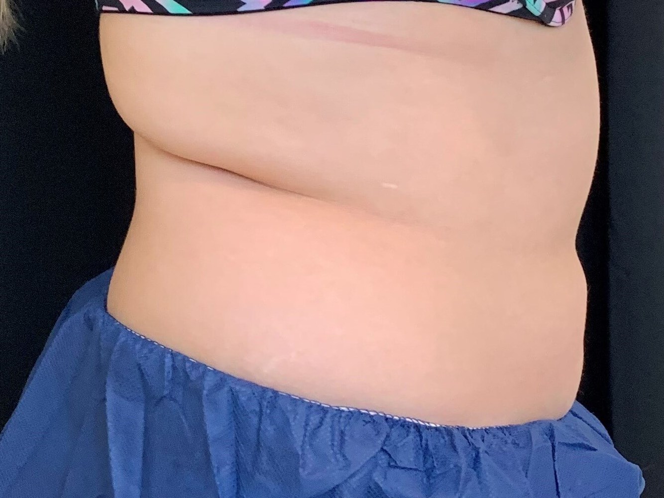 Before and After Pictures After